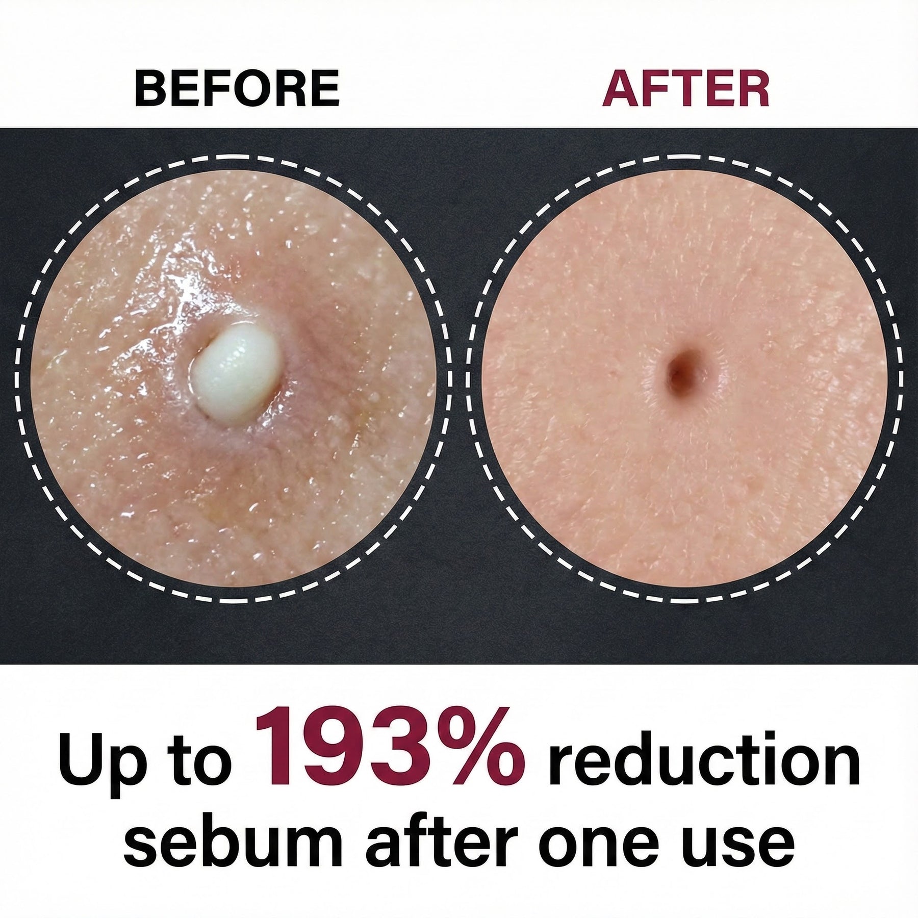 Black Peel Shot Glow Rice Ampoule