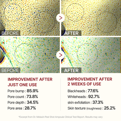 Black Peel Shot Glow Rice Ampoule